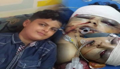 بسبب كرة قدم وقعت عليه.. مسلح حوثي يطلق النار مباشره على طفل بمدينة إب