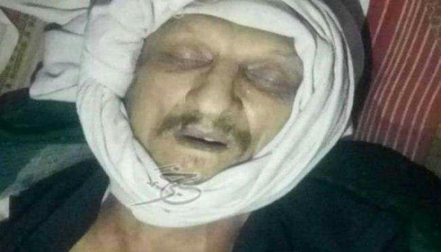 وفاة طبيب أوزباكستاني في سجون الحوثيين بإب