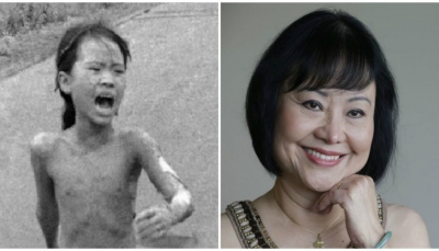 بعد 50 عاماً.. "فتاة النابالم" تكمل علاجها بعد إصابتها بغارة جوية أمريكية في فيتنام 